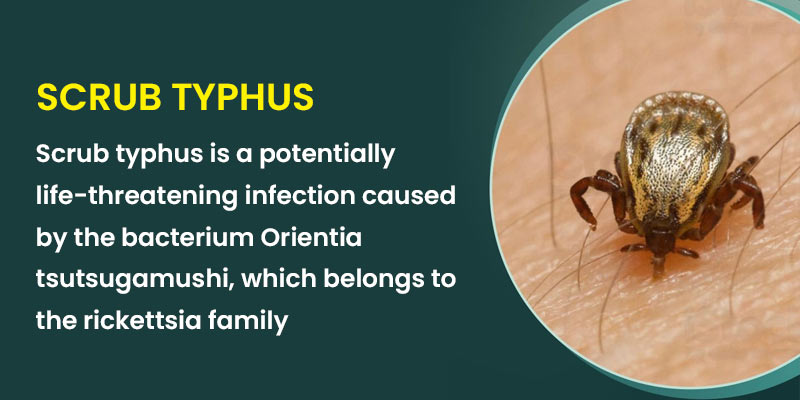 scrub-typhus