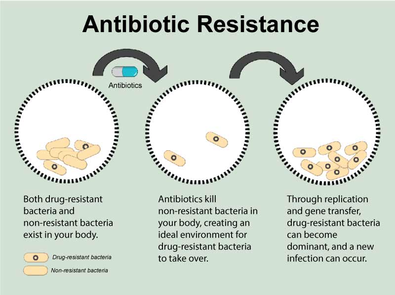 antibiotic