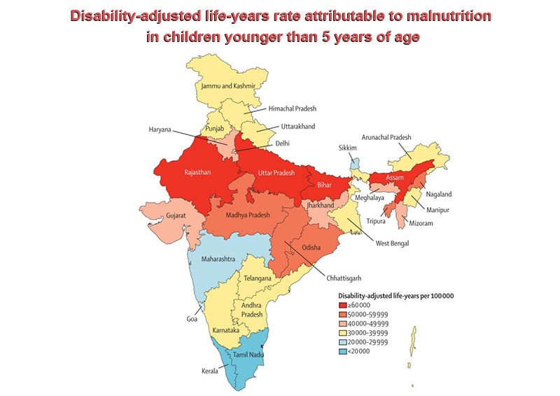 malnutrition-123