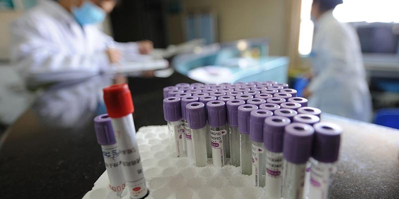 Explainer - What are monoclonal antibodies?