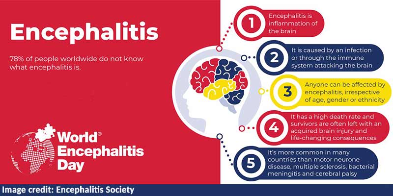 encephalitis