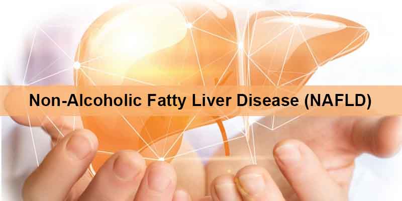 NAFLD